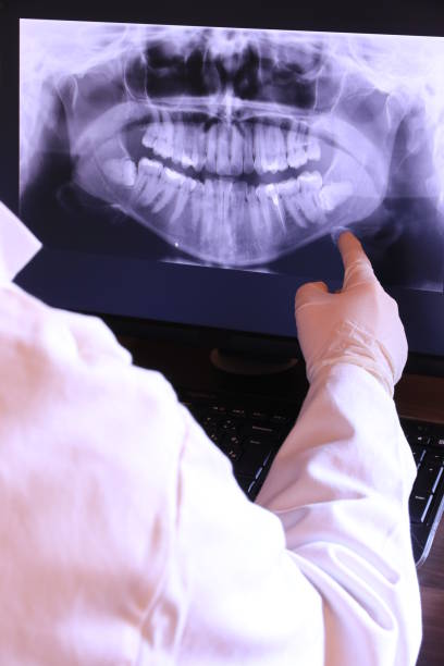 Tooth Infection Emergency Dentist in GA