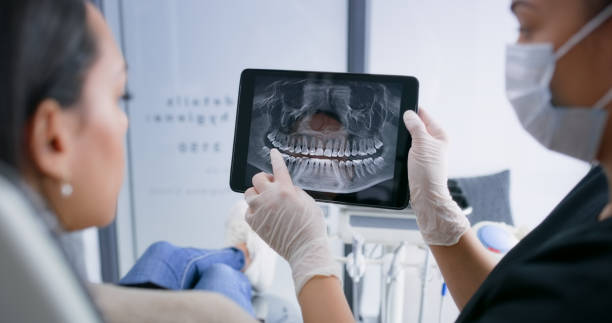 Emergency Dental Filling Replacement in GA
